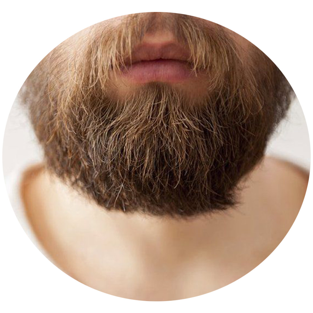 Beard-implantation-14