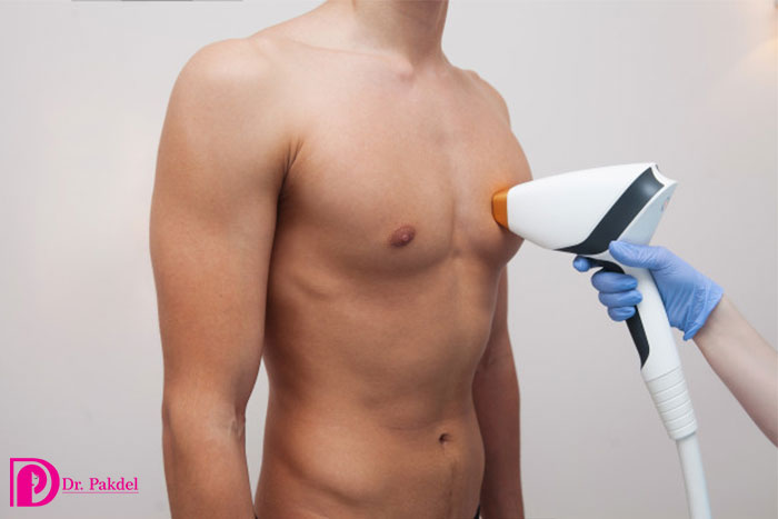 Laser-hair removal