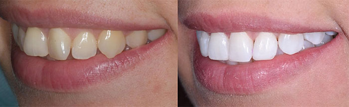 Cosmetic-dentistry-1