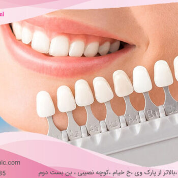 Dental composite-12