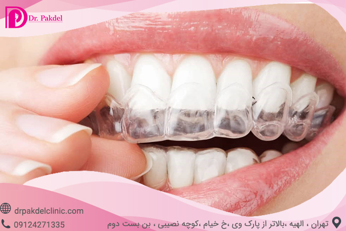 Dental orthodontics-1