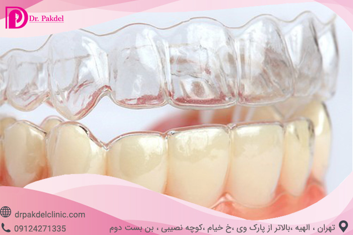 Dental orthodontics-10