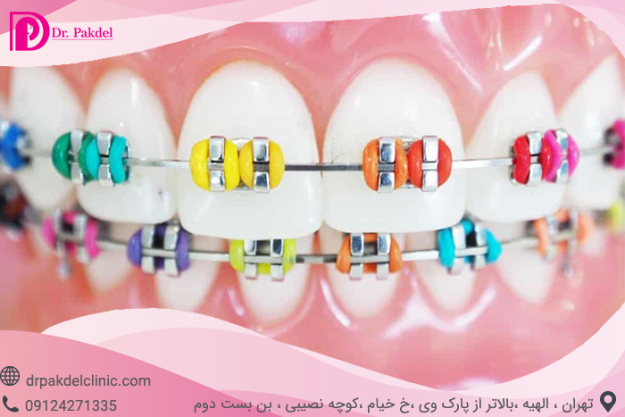 Dental orthodontics-11