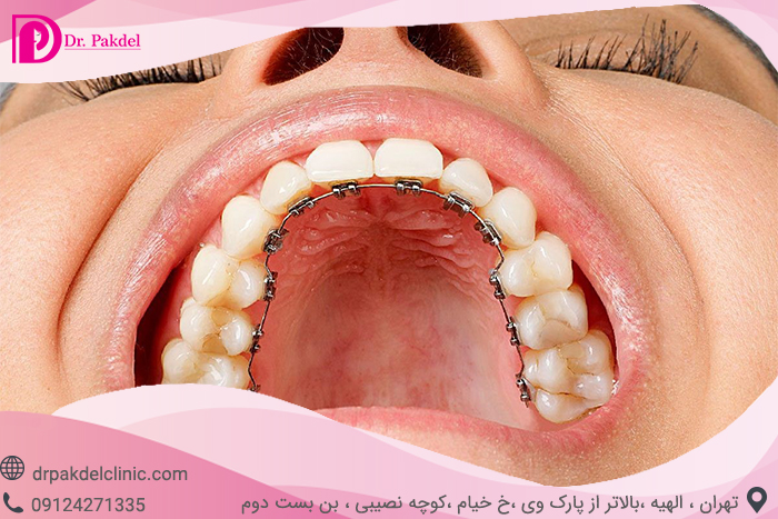 Dental orthodontics-15