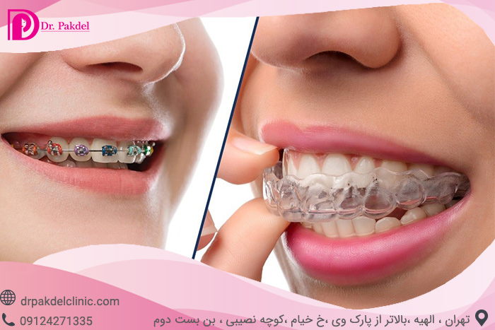 Dental orthodontics-16