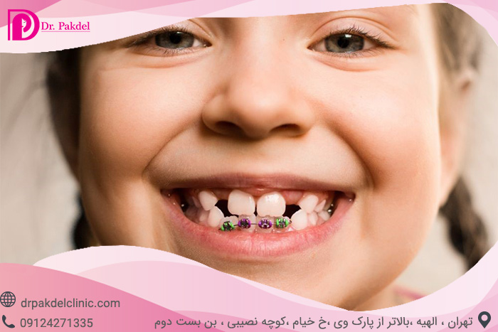 Dental orthodontics-17