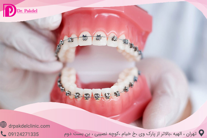 Dental orthodontics-18