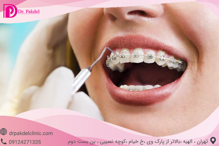Dental orthodontics-21