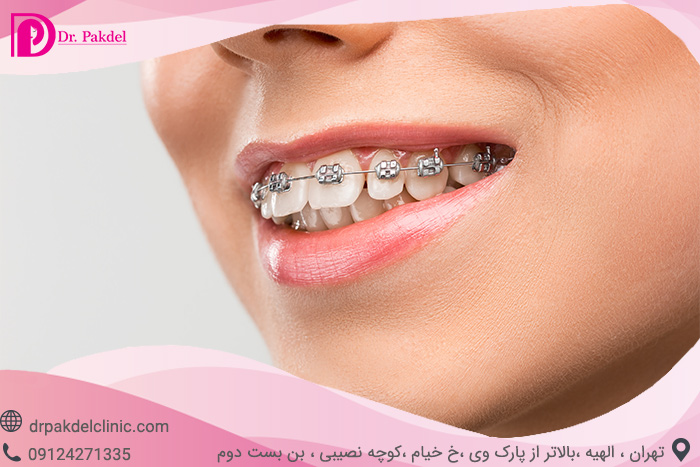 Dental orthodontics-22