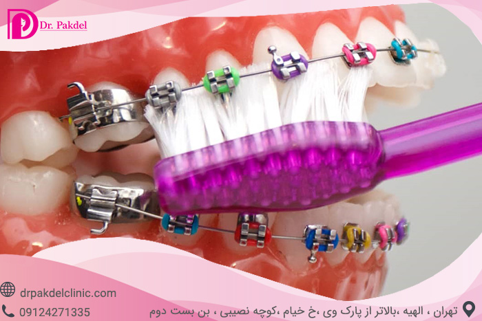 Dental orthodontics-10