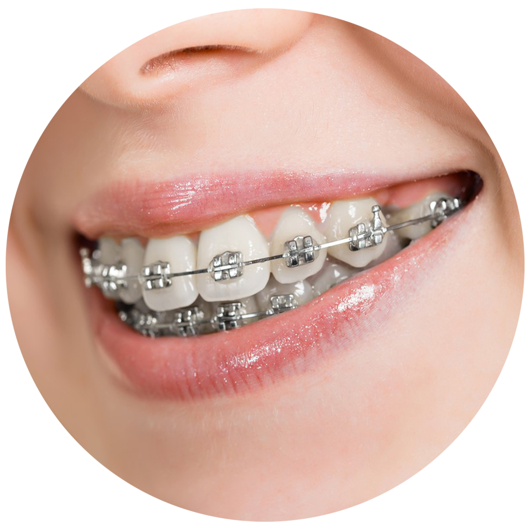 Dental orthodontics-24