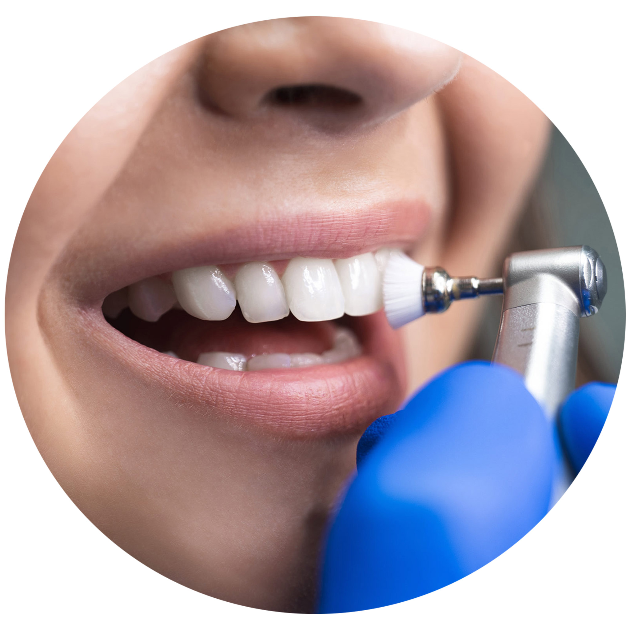 Teeth-scaling-drpakdelclinic
